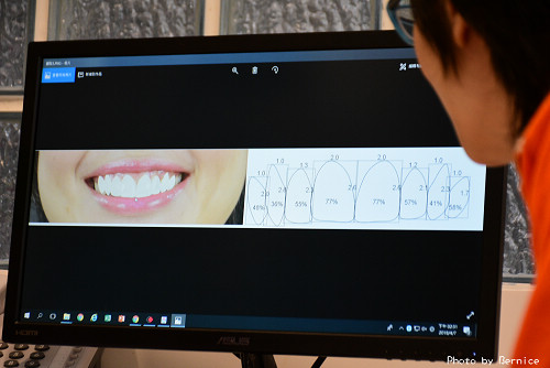林口牙醫推薦~萊德美學牙醫DSD數位美齒技術發表會 @Bernice的隨手筆記